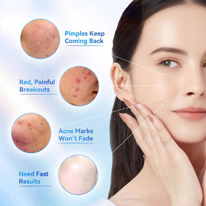 Oroluna ClearSpot 24H Drying Lotion